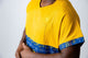 tunique médical homme jaune avec détails ethniques bleus, tenue professionnelle élégante twopikal wear , uniforme coloré caribéen infirmier ou aide soignante avec poche stylo.